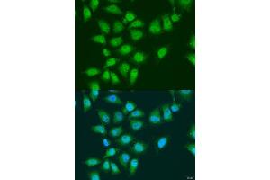 Immunofluorescence analysis of U2OS cells using EY antibody (ABIN7267073) at dilution of 1:100. (EYA3 anticorps  (AA 1-300))