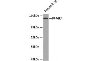 Western blot analysis of extracts of Mouse lung using PPP4R4 Polyclonal Antibody at dilution of 1:1000. (PPP4R4 anticorps)