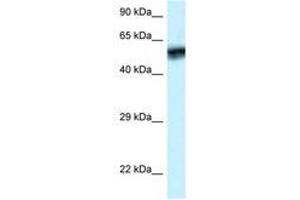 Image no. 1 for anti-Calcium/calmodulin-Dependent Protein Kinase IV (CAMK4) (AA 53-102) antibody (ABIN6747334) (CAMK4 anticorps  (AA 53-102))