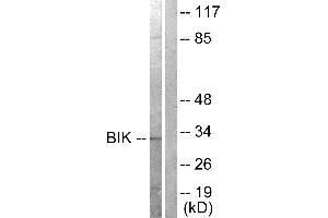 Western blot analysis of extracts from A549 cells, treated with DMSO (0. (BIK anticorps  (Thr33))