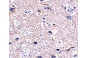 Immunohistochemistry (IHC) image for anti-Programmed Cell Death 1 (PDCD1) antibody (ABIN1031790)