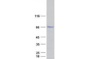 Validation with Western Blot