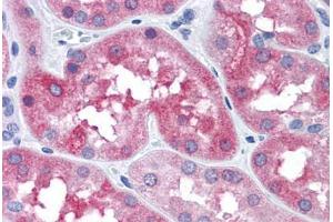 Human Kidney: Formalin-Fixed, Paraffin-Embedded (FFPE)