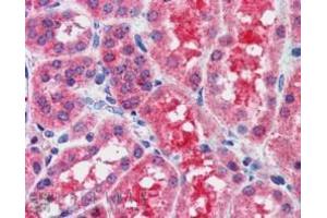 Image no. 3 for anti-Suppressor of Cytokine Signaling 1 (SOCS1) (C-Term) antibody (ABIN374072) (SOCS1 anticorps  (C-Term))