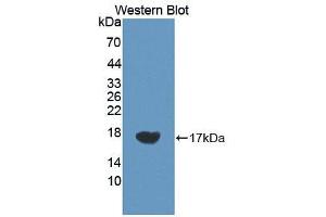Western blot analysis of the recombinant protein. (VEGFC anticorps  (AA 212-327))
