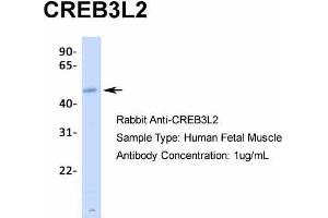 Host:  Rabbit  Target Name:  CREB3L2  Sample Type:  Human Fetal Muscle  Antibody Dilution:  1.