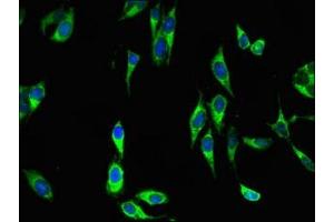 Immunofluorescent analysis of Hela cells using ABIN7150756 at dilution of 1:100 and Alexa Fluor 488-congugated AffiniPure Goat Anti-Rabbit IgG(H+L) (DUSP19 anticorps  (AA 1-217))