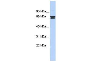 ZNF614 antibody used at 0. (ZNF614 anticorps  (Middle Region))