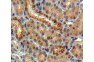 Used in DAB staining on fromalin fixed paraffin-embedded Kidney tissue