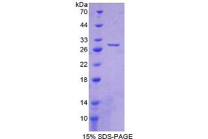 Image no. 1 for Crystallin, beta A1 (CRYBA1) (AA 1-215) protein (His tag) (ABIN6237865) (CRYBA1 Protein (AA 1-215) (His tag))