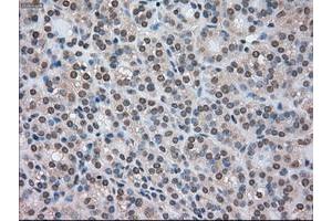 Image no. 6 for anti-Cancer/testis Antigen 1B (CTAG1B) antibody (ABIN1499905) (CTAG1B anticorps)