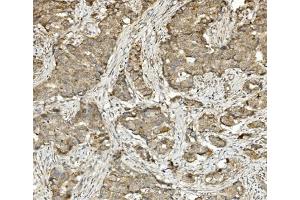 IHC analysis of Methylmalonyl Coenzyme A using anti-Methylmalonyl Coenzyme A antibody (ABIN7603112). (MUT anticorps  (N-Term))