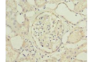 Immunohistochemistry of paraffin-embedded human kidney tissue using ABIN7174771 at dilution of 1:100 (C19orf48 anticorps  (AA 1-117))