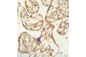 Formalin fixed and paraffin embedded human placenta tissue reacted with PSG9 Antibody (Center) followed by peroxidase conjugation of the secondary antibody and DAB staining. (PSG9 anticorps  (Middle Region))