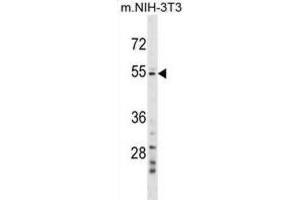 Western Blotting (WB) image for anti-Glutamic Pyruvate Transaminase (Alanine Aminotransferase) 2 (GPT2) antibody (ABIN2999879) (GPT2 anticorps)