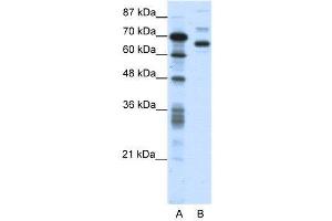 WB Suggested Anti-CTCFL  Antibody Titration: 0. (CTCFL anticorps  (N-Term))