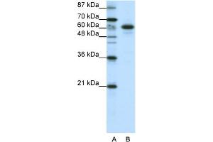 WB Suggested Anti-CBLL1 Antibody Titration:  1. (CBLL1 anticorps  (C-Term))