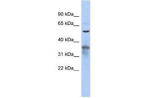 WB Suggested Anti-RAB3IP Antibody Titration: 0. (RAB3IP anticorps  (N-Term))