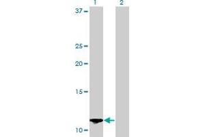 Western Blot analysis of S100A13 expression in transfected 293T cell line by S100A13 monoclonal antibody (M01), clone 3A7.
