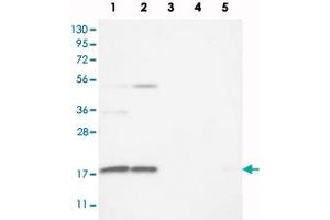 Western blot analysis of Lane 1: RT-4, Lane 2: U-251 MG, Lane 3: Human Plasma, Lane 4: Liver, Lane 5: Tonsil with RPS25 polyclonal antibody  at 1:100 - 1:250 dilution. (RPS25 anticorps)
