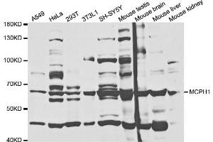 Western blot analysis of extracts of various cell lines, using MCPH1 antibody (ABIN5973185) at 1/1000 dilution. (MCPH1 anticorps)