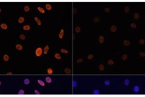 Immunofluorescence analysis of C6 cells using Acetyl-Histone H2B-K12 Polyclonal Antibody at dilution of 1:100.