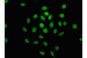 Immunofluorescence staining of A549 cells with ABIN7150334 at 1:100, counter-stained with DAPI.