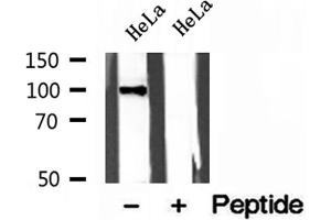Western blot analysis of extracts of HeLa cells, using LONP1 antibody. (LONP1 anticorps  (C-Term))
