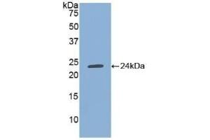 Detection of Recombinant TIMP1, Human using Polyclonal Antibody to Tissue Inhibitors Of Metalloproteinase 1 (TIMP1) (TIMP1 anticorps  (AA 25-207))