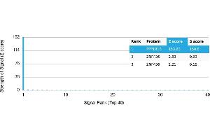 Protein Array (PAr) image for anti-Protein Phosphatase 1, Regulatory (Inhibitor) Subunit 1B (PPP1R1B) antibody (ABIN7456005)