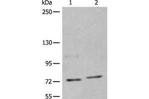 Western blot analysis of 562 and Jurkat cell lysates using NCAPH Polyclonal Antibody at dilution of 1:450 (NCAPH anticorps)
