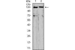 Western blot analysis using OTUD4 mouse mAb against HepG2 (1) and C6 (2) cell lysate.