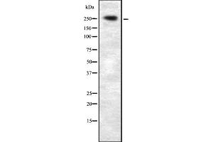 Western blot analysis of PLCE1 expression in HEK293 cells ,The lane on the left is treated with the antigen-specific peptide. (PLCE1 anticorps)