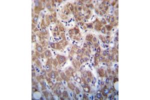 OC2 Antibody (Center) 7796c immunohistochemistry analysis in formalin fixed and paraffin embedded human liver tissue followed by peroxidase conjugation of the secondary antibody and DAB staining.