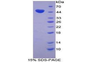 SDS-PAGE analysis of Cow Chromogranin B Protein. (CHGB Protéine)