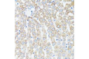 Immunohistochemistry of paraffin-embedded rat liver using CYCS antibody. (Cytochrome C anticorps  (AA 1-105))