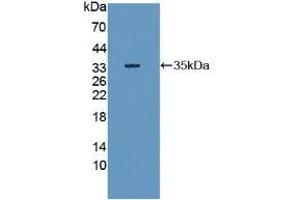 Figure. (RIPK1 anticorps  (AA 17-289))
