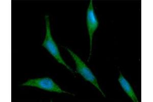 ICC/IF analysis of RNH1 in PC3 cells line, stained with DAPI (Blue) for nucleus staining and monoclonal anti-human RNH1 antibody (1:100) with goat anti-mouse IgG-Alexa fluor 488 conjugate (Green).