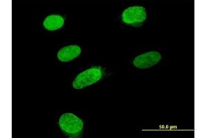 Immunofluorescence of purified MaxPab antibody to ARID3B on HeLa cell.