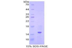 SDS-PAGE (SDS) image for Cystatin B (Stefin B) (CSTB) (AA 1-98) protein (His tag) (ABIN1879293)