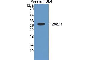 Detection of Recombinant LAMb4, Human using Polyclonal Antibody to Laminin Beta 4 (LAMb4) (LAMb4 anticorps  (AA 1543-1759))
