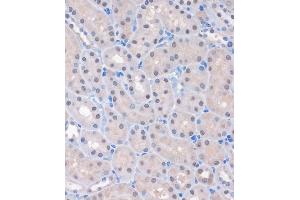 Immunohistochemistry of paraffin-embedded Mouse kidney using MTMR8 Rabbit pAb (ABIN7268766) at dilution of 1:100 (40x lens). (MTMR8 anticorps  (AA 430-560))