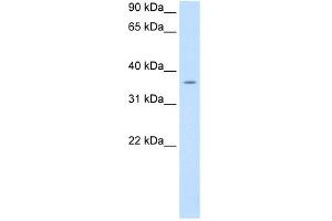 WB Suggested Anti-PON1 Antibody Titration:  0. (PON1 anticorps  (C-Term))
