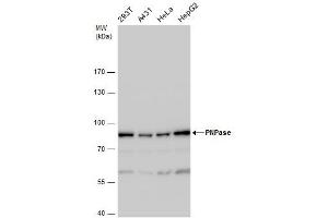 WB Image PNPase antibody detects PNPase protein by western blot analysis. (PNPT1 anticorps)