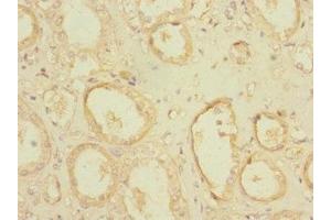 Immunohistochemistry of paraffin-embedded human kidney tissue using ABIN7163729 at dilution of 1:100 (POGK anticorps  (AA 101-400))