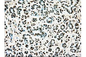 Immunohistochemical staining of paraffin-embedded breast tissue using anti-TYRO3 mouse monoclonal antibody. (TYRO3 anticorps)