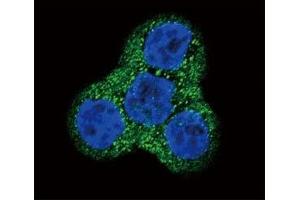 Confocal immunofluorescent analysis of PDGFR beta antibody with WiDr cells followed by Alexa Fluor 488-conjugated goat anti-rabbit lgG (green).