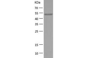 Western Blotting (WB) image for Glutathione Synthetase (GSS) (AA 2-474) protein (His tag) (ABIN7123153) (Glutathione Synthetase Protein (GSS) (AA 2-474) (His tag))
