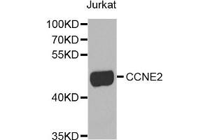 Western blot analysis of extracts of Jurkat cells, using CCNE2 antibody.