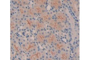 Used in DAB staining on fromalin fixed paraffin- embedded Kidney tissue
